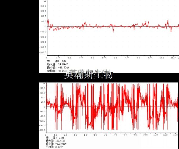 氯化锂诱导大鼠癫痫模型