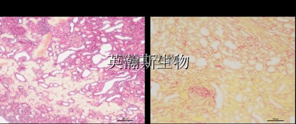 肝纤维化模型