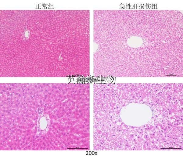 大鼠急性肝损伤模型