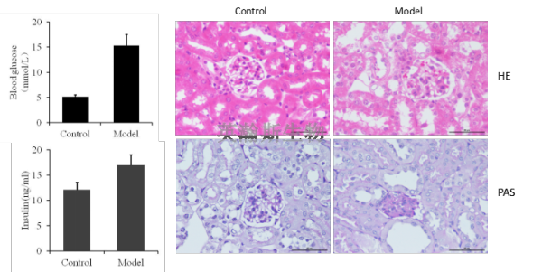 糖尿病模型的建立