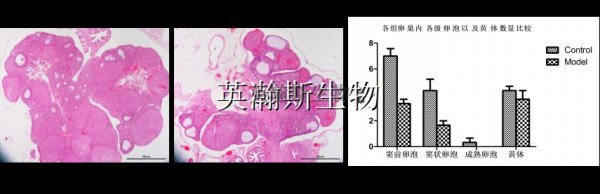 卵巢早衰模型的建立