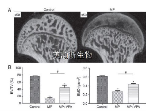 股骨头坏死模型