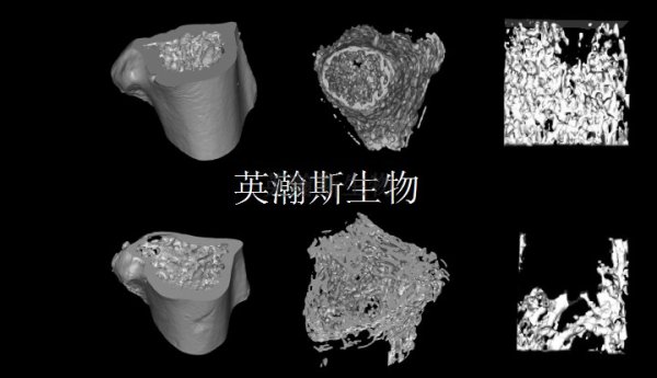 骨质疏松模型