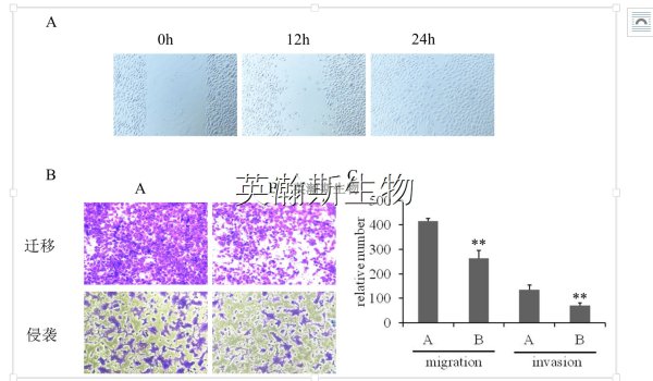 细胞实验-细胞运动能力检测