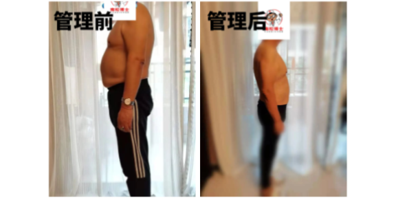西安尿酸管理公司,管理