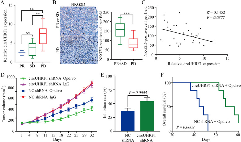 circUHRF1可以提高肝ai对抗PD1治 疗的耐药性