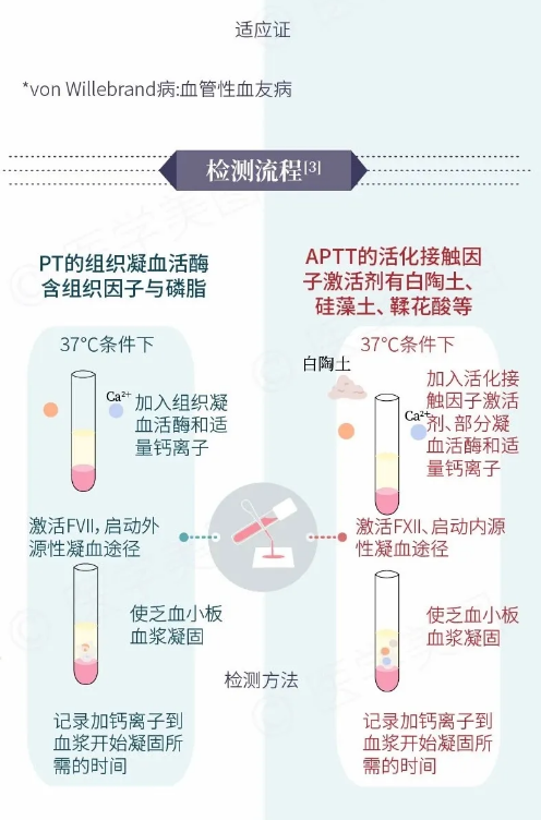 一图读懂凝血酶原时间vs活化部分凝血活酶时间