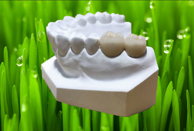 产品中心 固定牙钛合金与陶瓷的结合力很好,钛合金烤瓷牙具有不易崩瓷