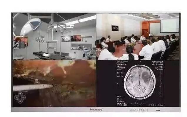 数字化手术室屏幕示意.png