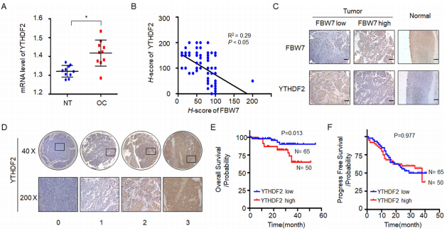 （4）YTHDF2与卵巢癌FBW7表达及预后呈负相关