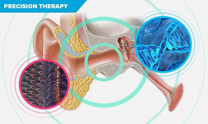 听觉损伤常见问题与解答4听觉统合训练系统