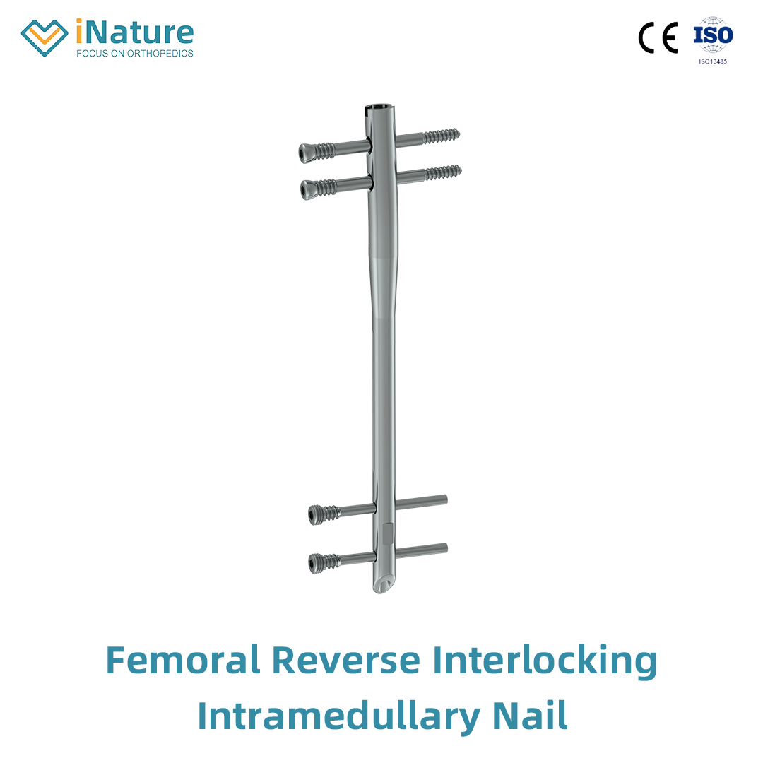 Femoral Reverse Interlocking Intramedullary Nail-| iNature ...