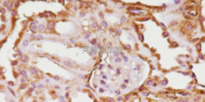 黑龙江整体病理实验外包公司,病理实验外包