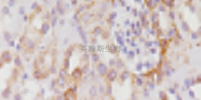 河南專業(yè)的病理實(shí)驗(yàn)外包推薦,病理實(shí)驗(yàn)外包