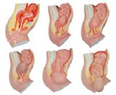 gao級(jí)足月胎兒分娩過程模型（6部件）