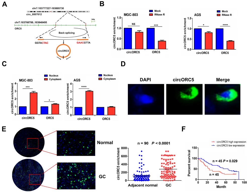 图4. circORC5定位于细胞质中，且在GC组织中表达上调