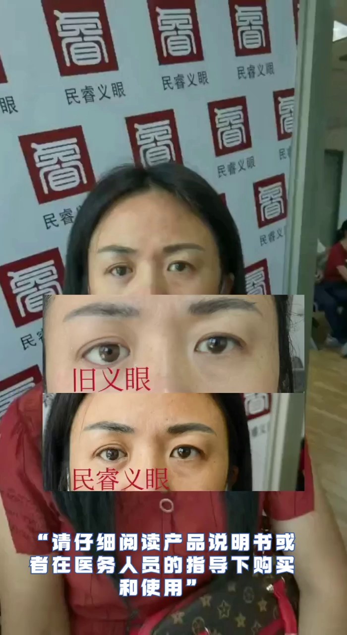 中国澳门仿真超薄义眼片在哪里,超薄义眼片