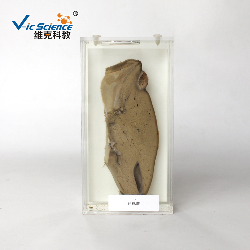 病理大体标本--肝脓肿全国服务热线:0373-5128357产品详情在线询价上