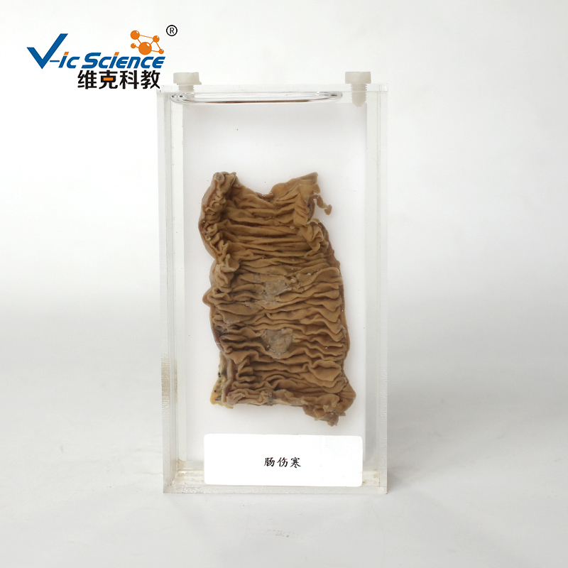 肠伤寒标本_肠伤寒标本厂家-新乡市维克科教仪器有限公司