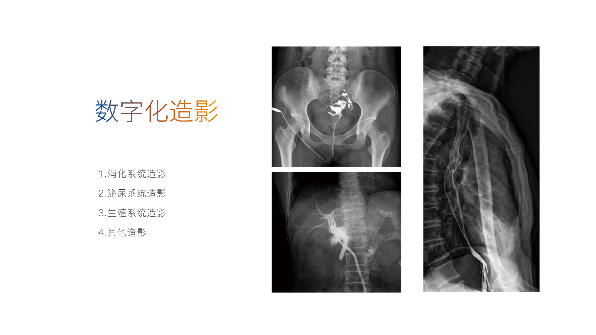 530/590天狼星系列旗舰动态平板DR