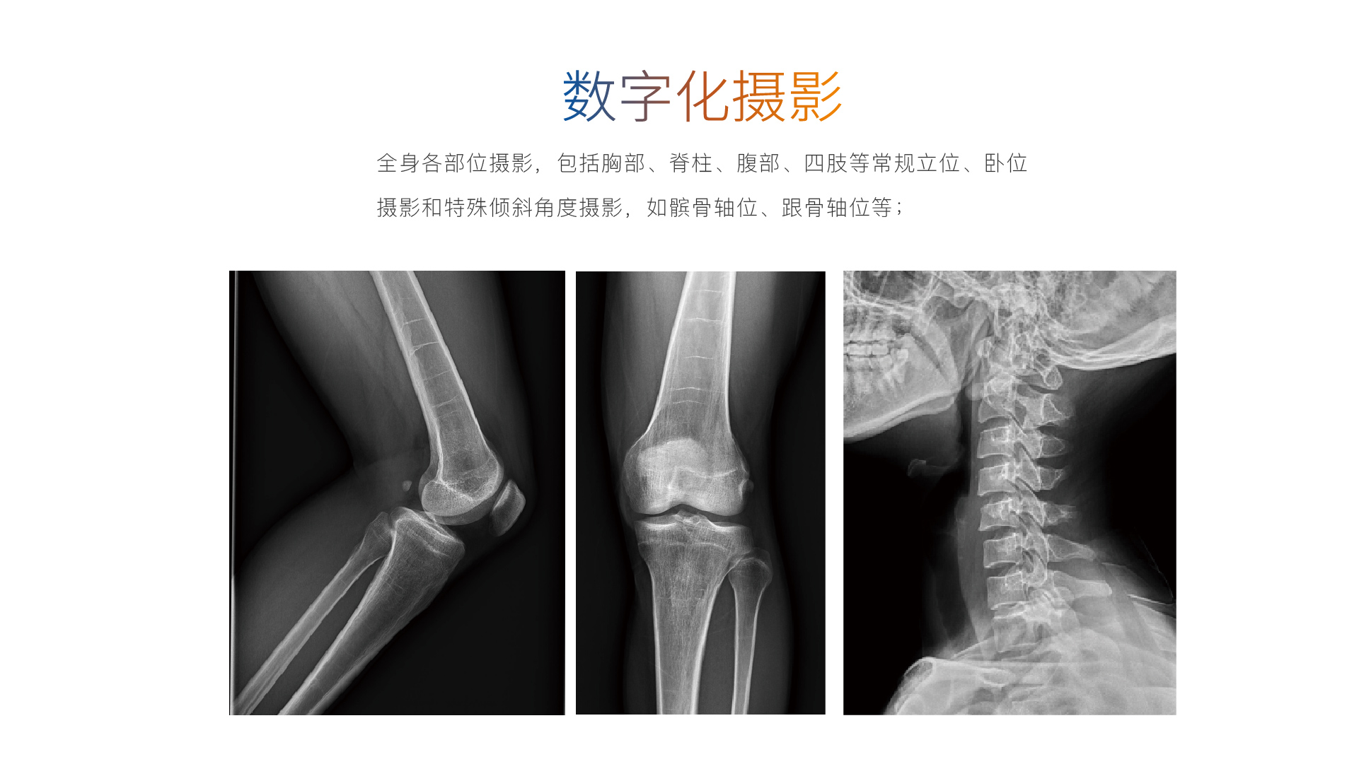 500/550天狼星系列UC臂动态平板DR