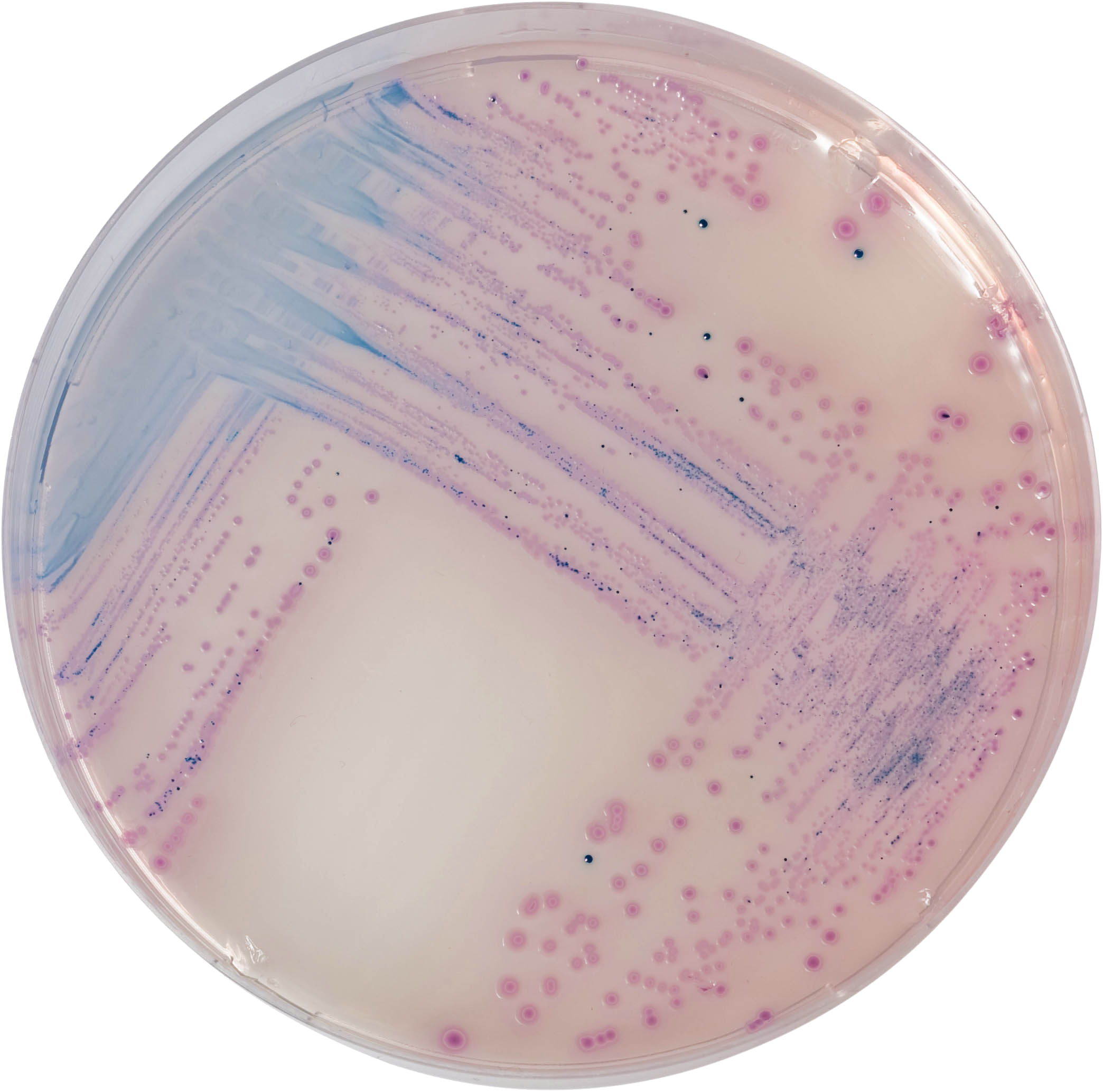 沙门氏菌显微图片