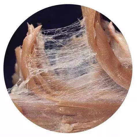 旗音qiyin:筋膜的秘密是什么?筋膜与疼痛又是怎样的关系?