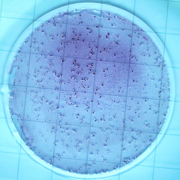 大肠菌群、菌落总数测试片视觉数量识别技术服务