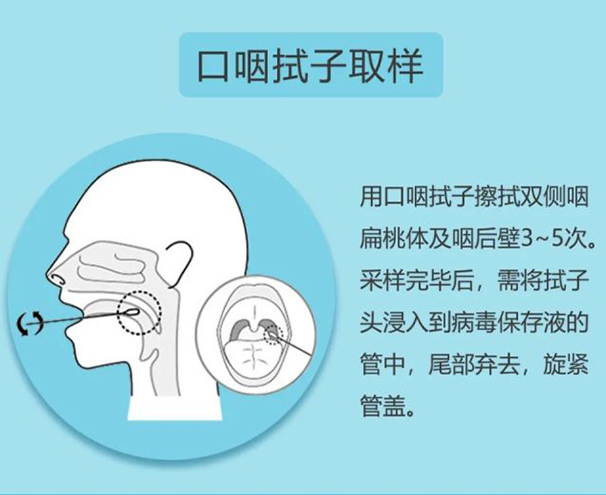 69鼻咽拭子,口咽拭子的取样位置比较深,对于采集的深度都有一定的