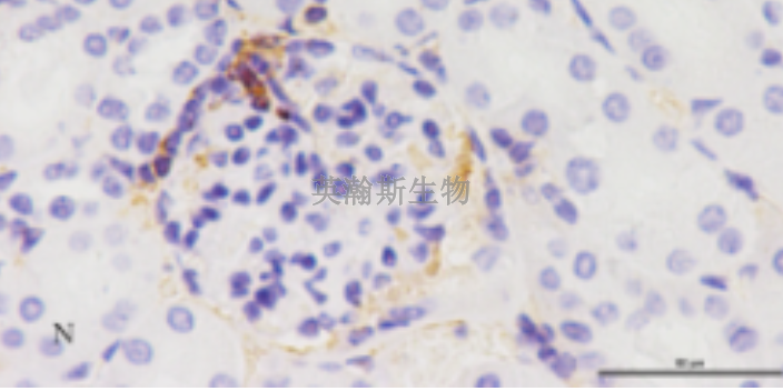 新疆病理免疫組化要多少錢