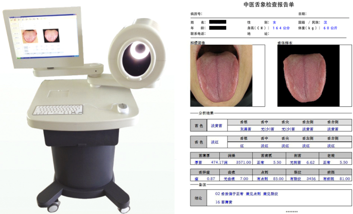 上海寶松堂中醫(yī)舌診圖像分析系統(tǒng)3.png