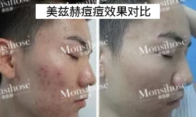 美茲赫**.png