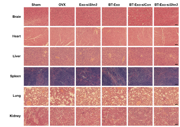 图10 用H&E染色法评价BT-Exo-siShn3的体内毒性