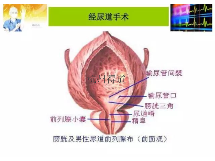 手術(shù)等離子電切鏡效果