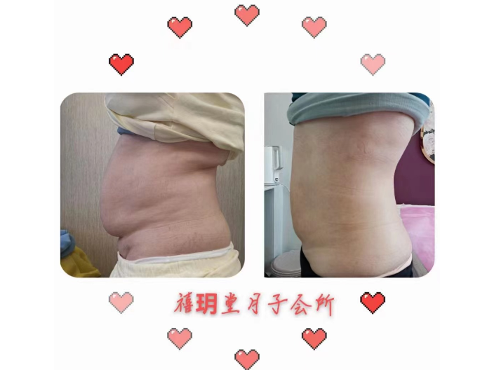 貴州產后腹部松弛恢復安全和效果有保障嗎 貴州金絲巾大健康產業供應