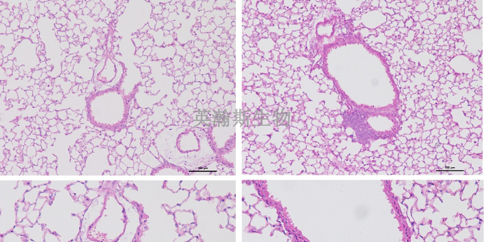 江苏结果客观的HE染色报告