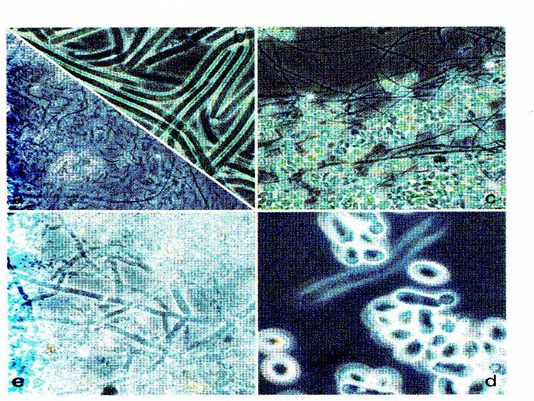 表面微生物粘泥處理