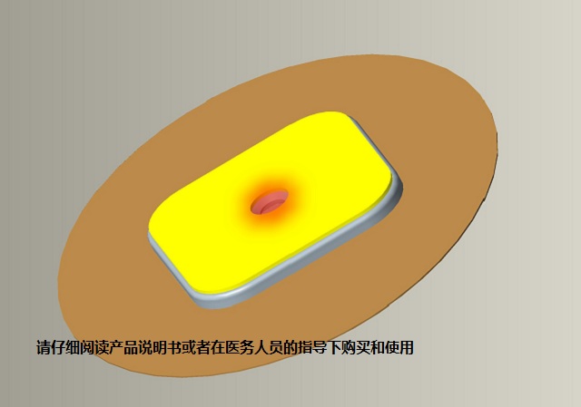 福建消除炎症消肿光子理疗贴哪家便宜