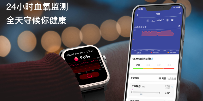 上海进口血氧监测智能手表