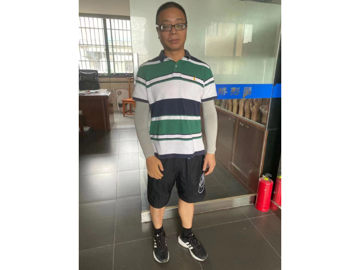 無(wú)錫智能假肢裝配 無(wú)錫雙健假肢與矯形器供應(yīng)