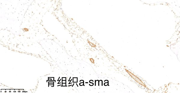 骨組織脫鈣