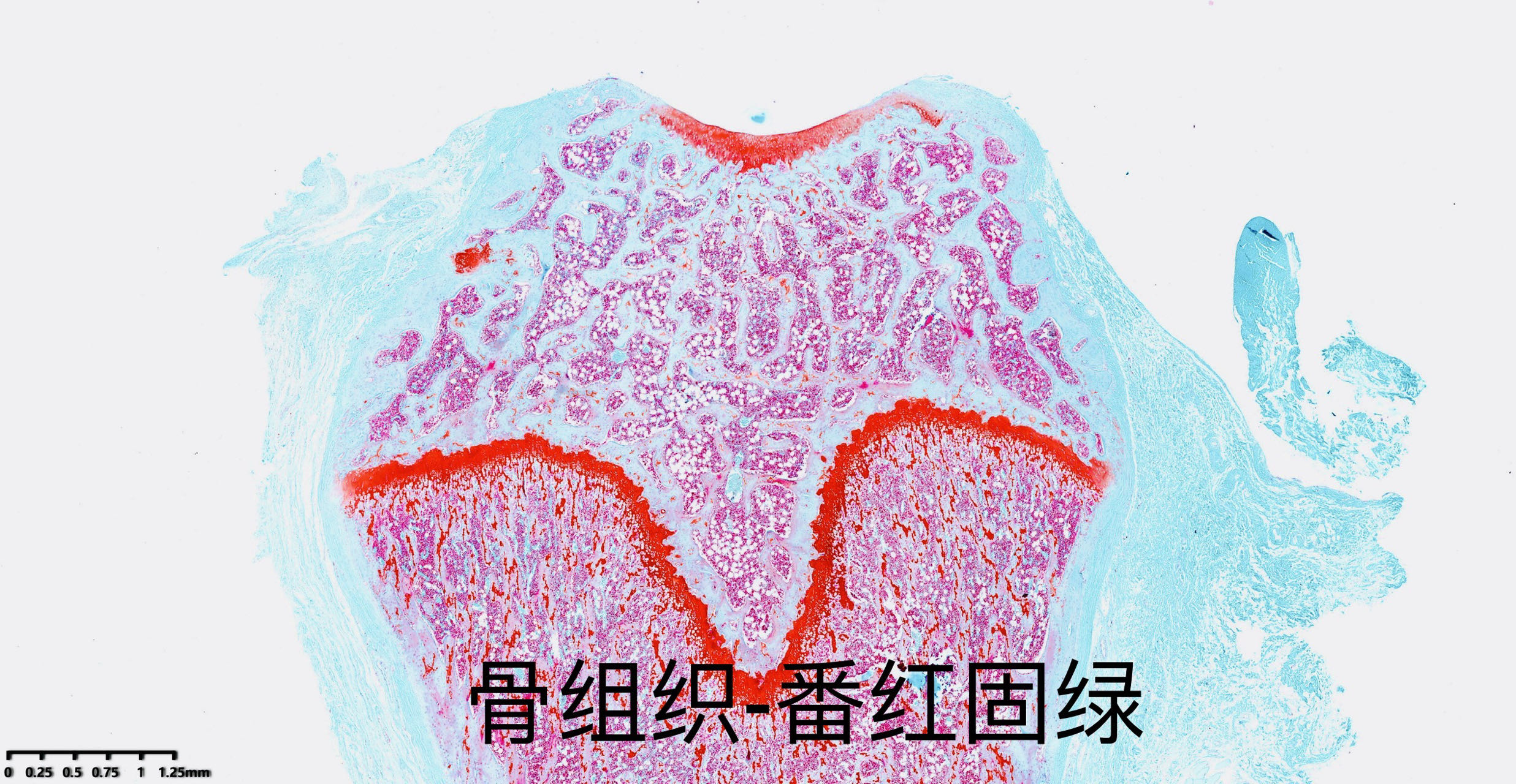 骨組織脫鈣