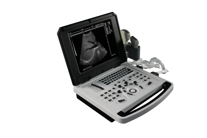 EC-83 Full Digital Ultrasound Scanner