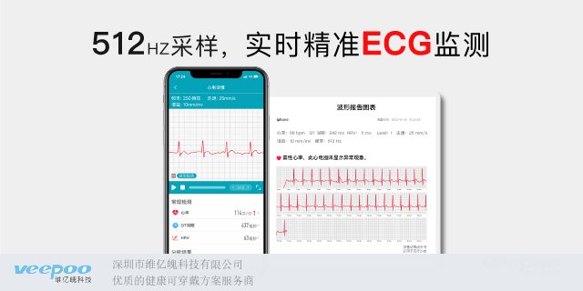 上海定制心电监测案例