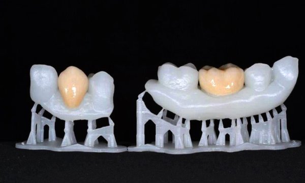 牙科義齒