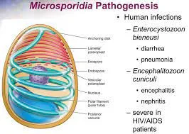 microsporidiosis