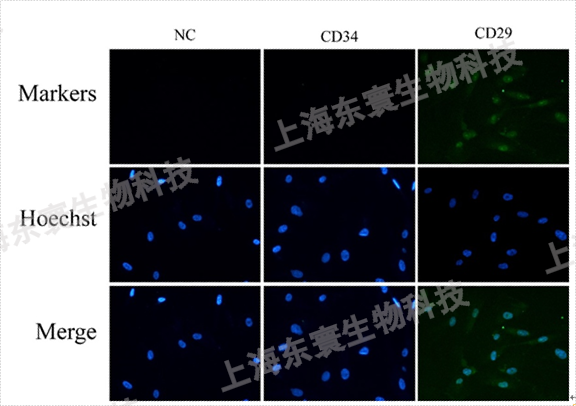 HUCMSC(人臍間充質(zhì)干細(xì)胞細(xì)胞)