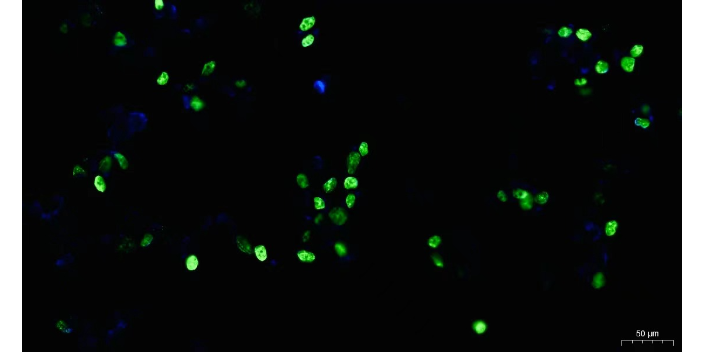 BAX免疫荧光检查 上海睿宝和生物科技供应