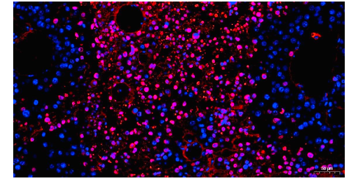 alpha 1 Fetoprotein免疫组化IHC