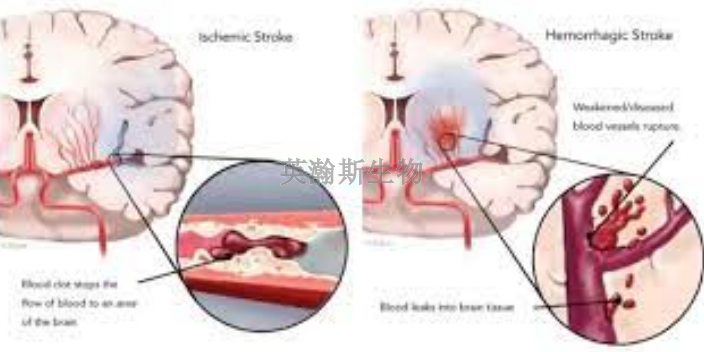 黑龙江MCO脑缺血再灌注模型实验,脑缺血再灌注模型